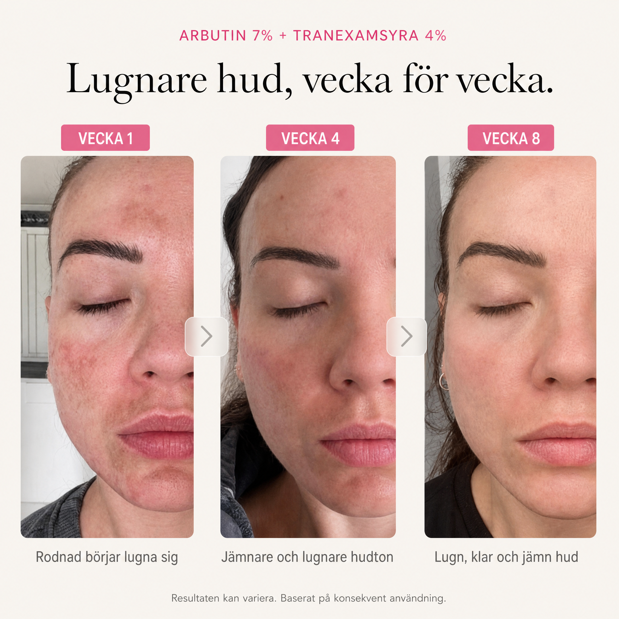 Velvionna – Arbutin 7% + Tranexamic Acid Brightening Cream