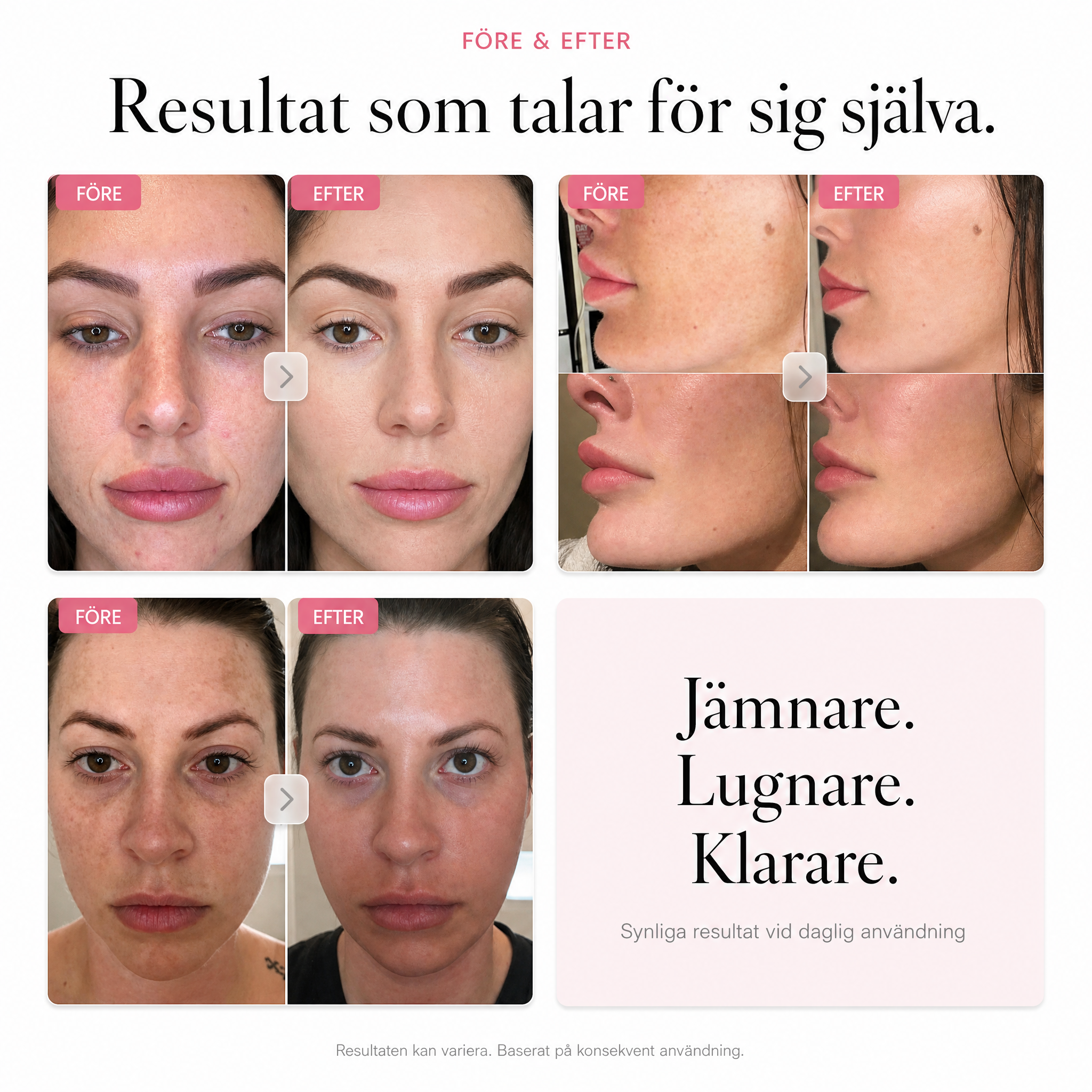 Velvionna – Arbutin 7% + Tranexamic Acid Brightening Cream