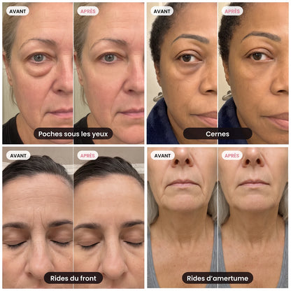 V-Lift™ Sérum Lift Instantané | PDRN + Peptides