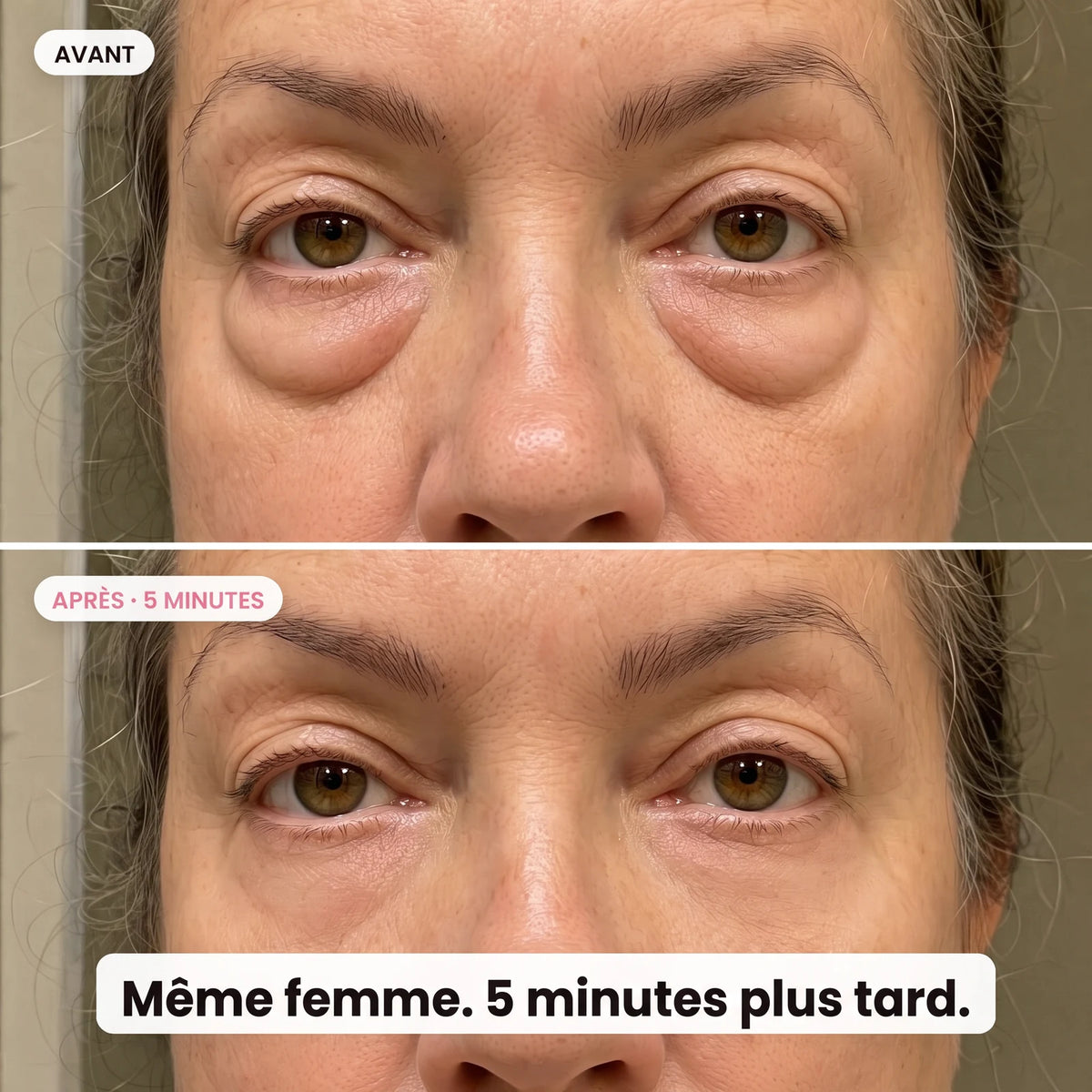 V-Lift™ Sérum Lift Instantané | PDRN + Peptides