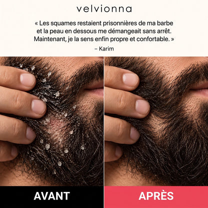 Avant / après sur la barbe