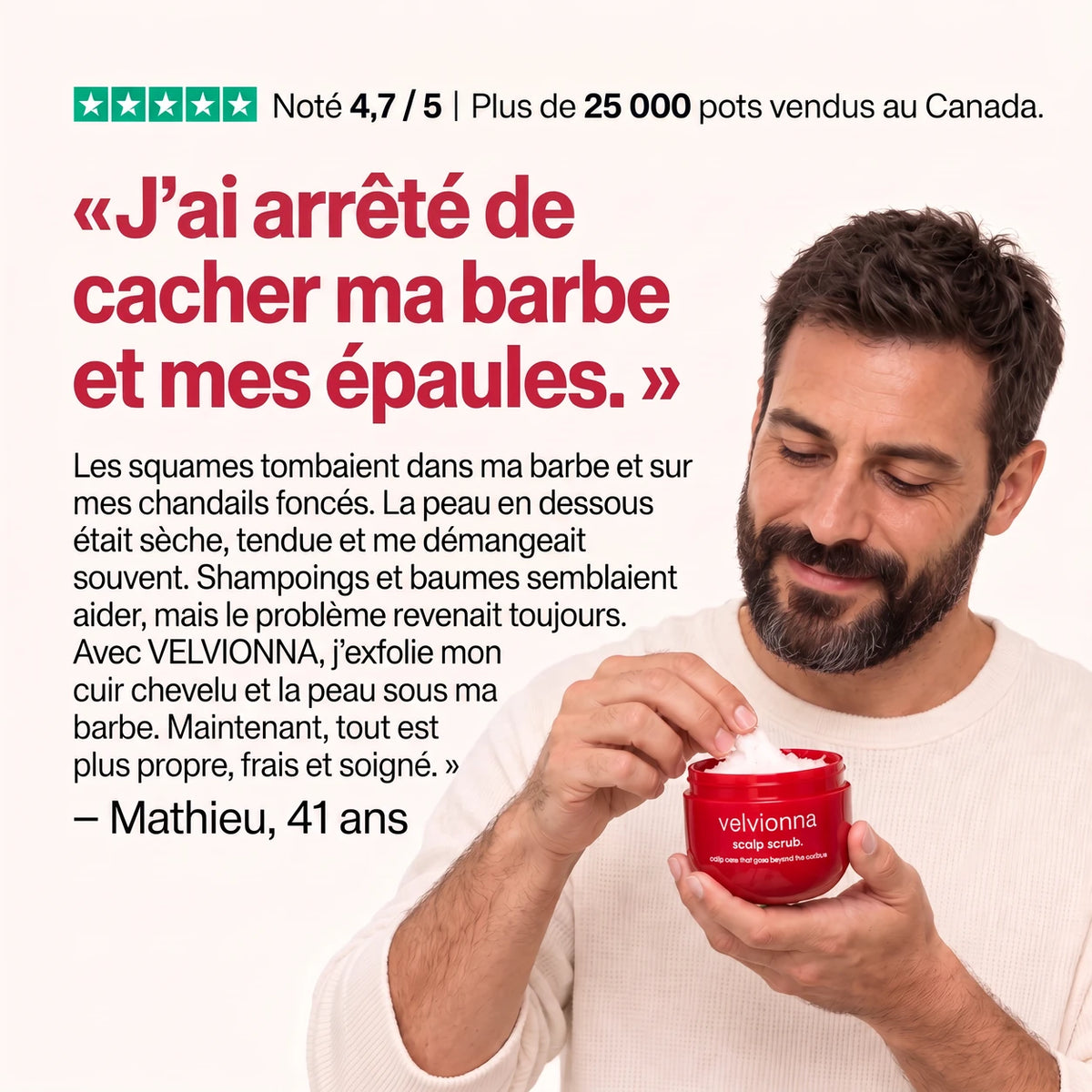 Témoignage : « J'ai arrêté de cacher ma barbe et mes épaules. »