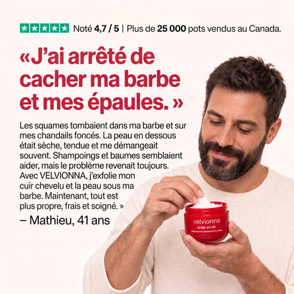 Témoignage : « J'ai arrêté de cacher ma barbe et mes épaules. »
